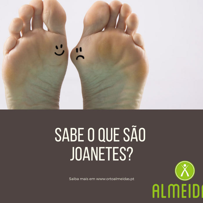 Joanetes