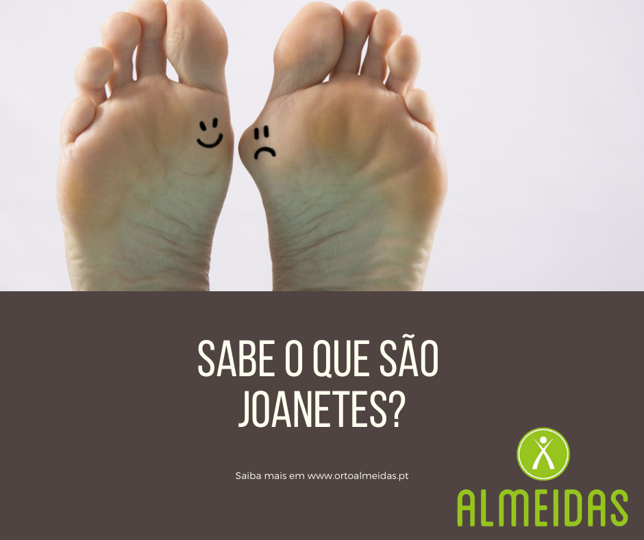 Joanetes