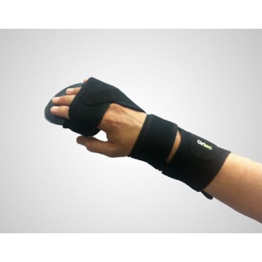 Hand Splint with Positional Control - MN300