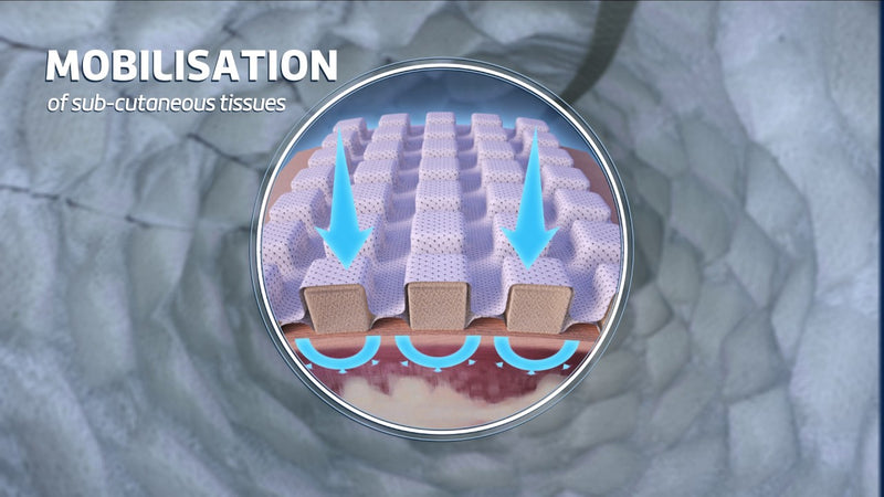 Mobiderm AUTOFIT - Linfedema