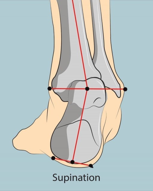 Palmilha Pé Supinado