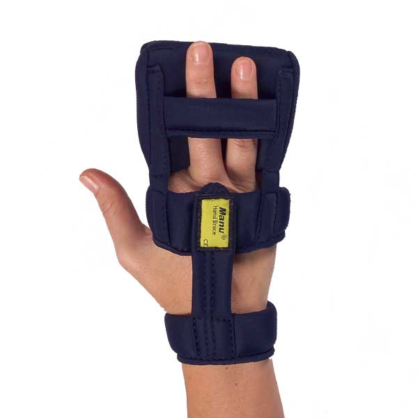 Night orthosis for carpal tunnel syndrome